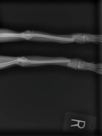 x ray new.jpeg